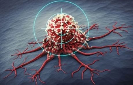 Des chercheurs français développent un kit pour détecter les cellules souches cancéreuses
