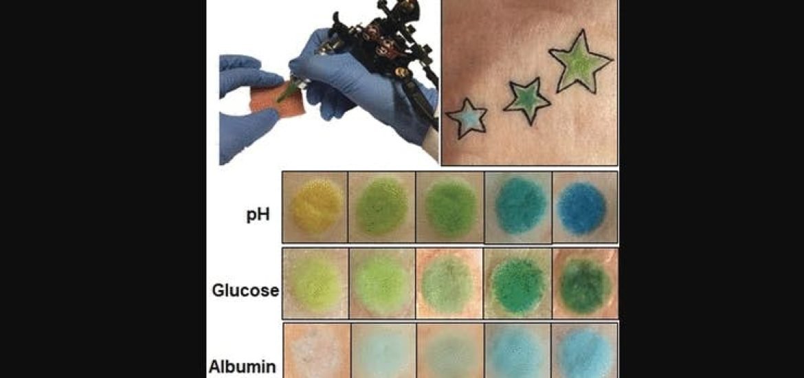 Le tatouage colorimétrique comme marqueur médical