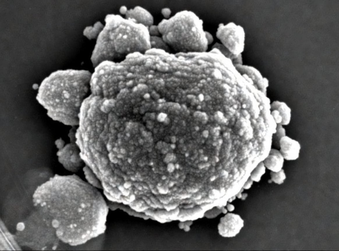 Des chercheurs développent une nouvelle classe d&rsquo;antibiotiques efficace contre les bactéries résistantes