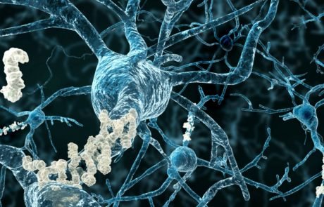 New hope for Alzheimer’s treatment: Biogen and  Eisai report promising results from Phase II Clinical Study of BAN2401