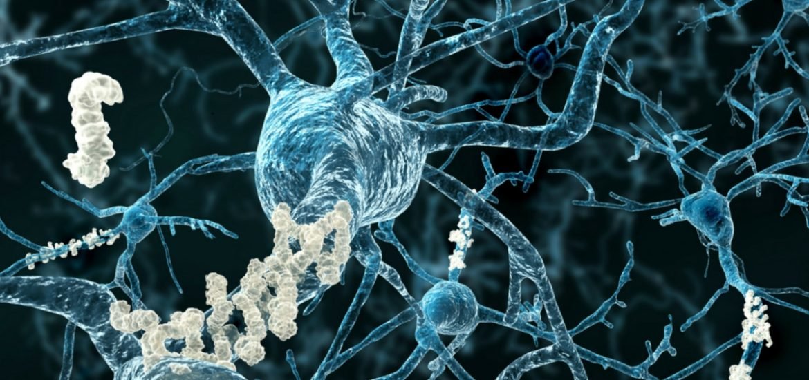 New hope for Alzheimer’s treatment: Biogen and Eisai report promising results from Phase II Clinical Study of BAN2401