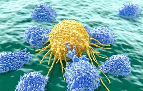 CRISPR-edited CAR T cells pass the safety test