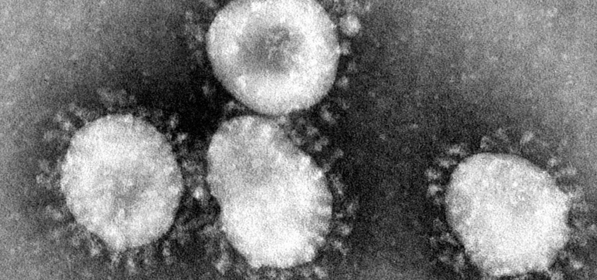 Aktuelle Covid-19 Studien: Virus natürlichen  Ursprungs, Risikogruppe Raucher