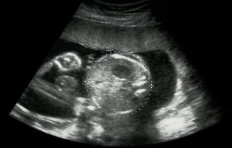 Research halted after eleven babies died during a drug trial in the Netherlands