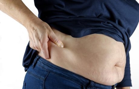 Weight-Loss Surgery May Lower Cancer Risk