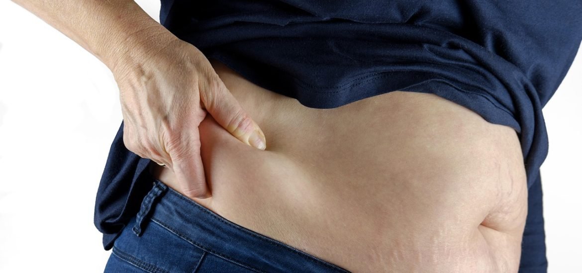 Weight-Loss Surgery May Lower Cancer Risk