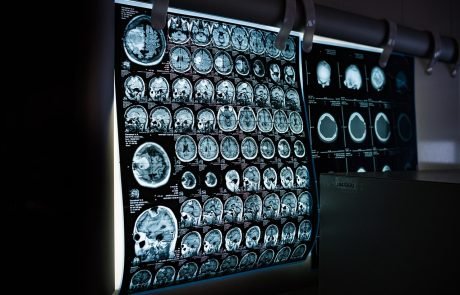 Can AI explain itself?