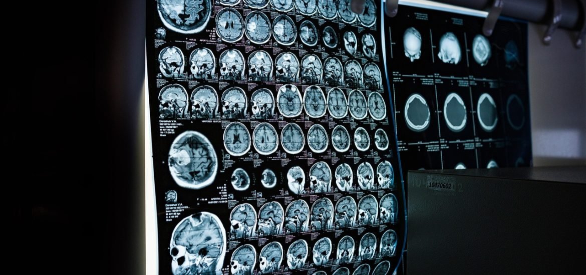 Can AI explain itself?