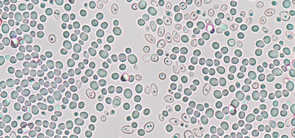 Researchers have restructured the entire yeast genome and packed it into one ‘super chromosome’