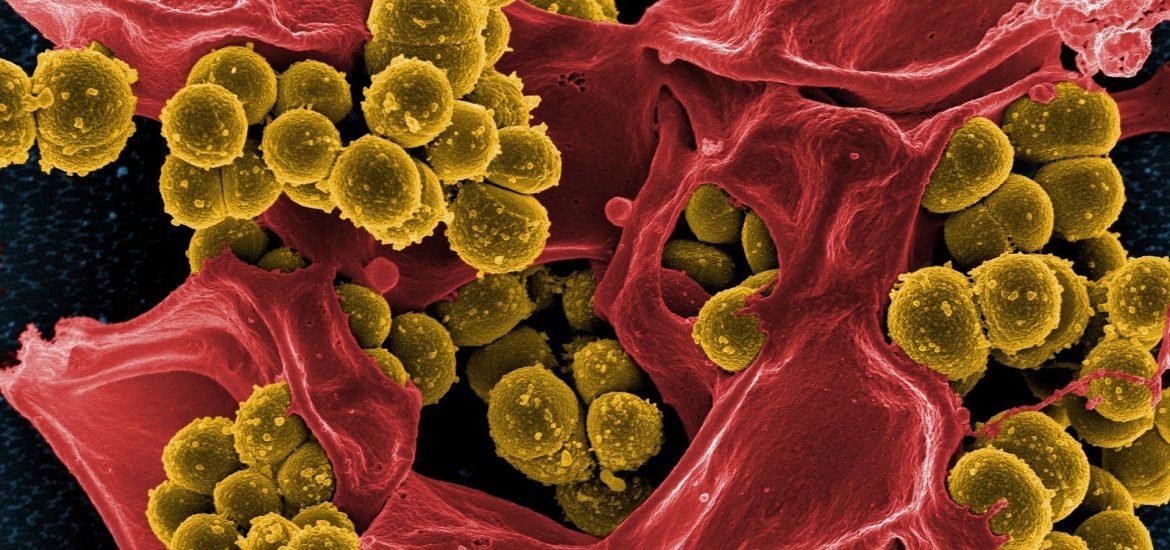 Scientists discover new antibiotic with potential to treat MRSA