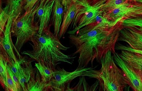 Bioinspired ‘scaffolds’ to improve wound healing