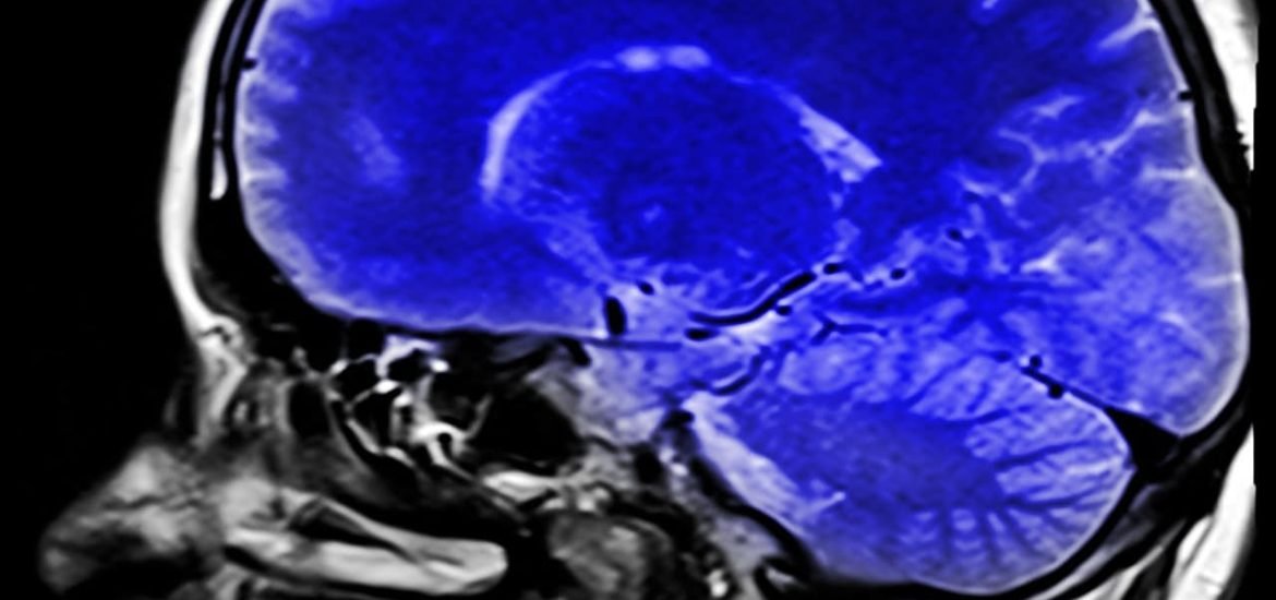 Scientists develop a revolutionary wearable brain scanner