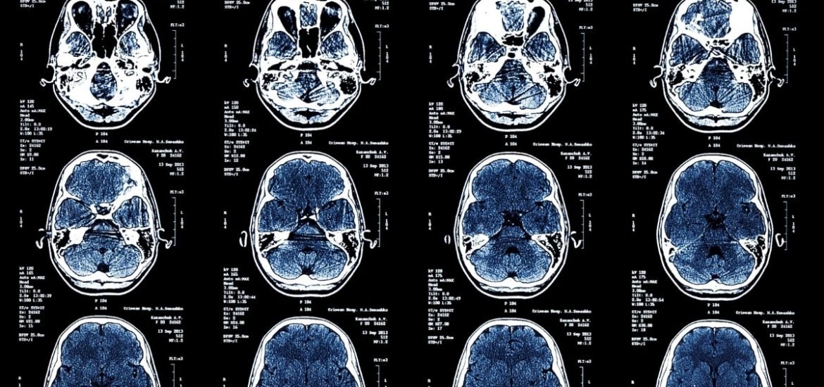 New study suggests women have “more youthful brains” than men