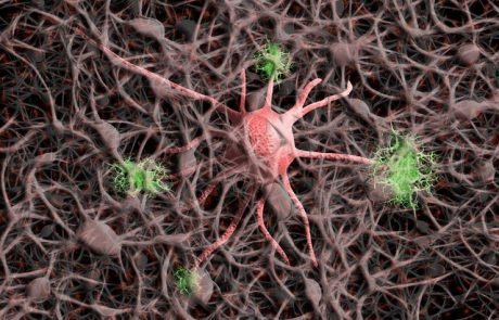 Tests mit Mäusen: Starke Neuronenbildung stellt das Gedächtnis bei Alzheimer wieder her