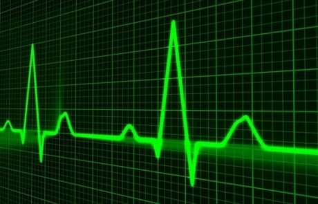 KI Tool erkennt tödliche Herzrhythmen