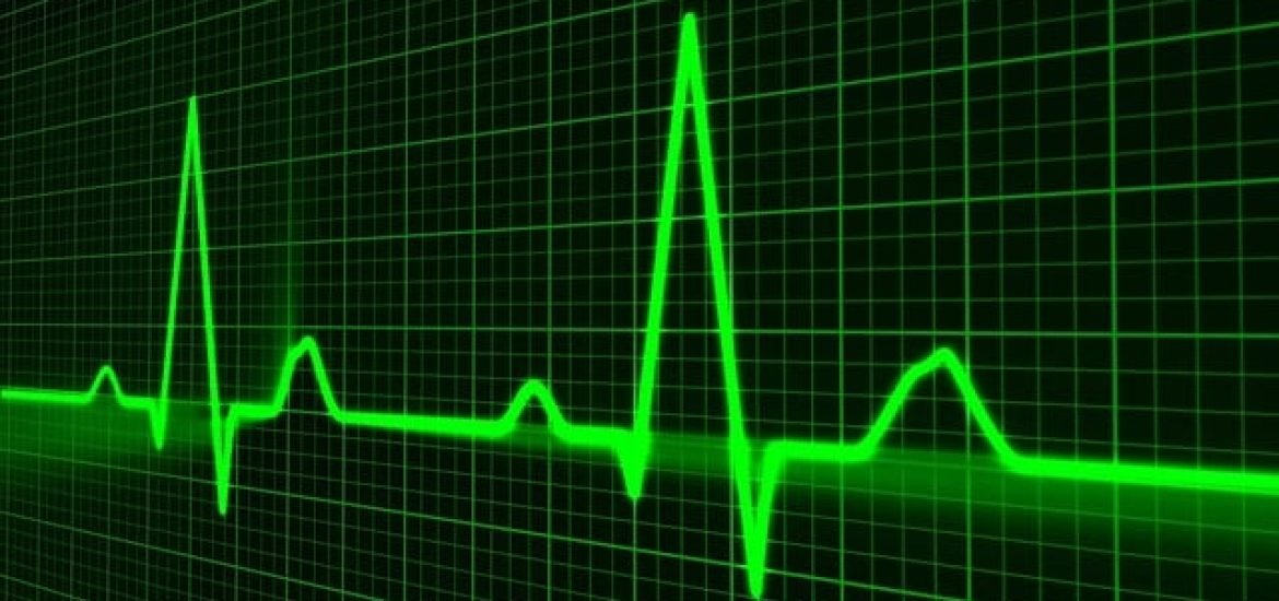 KI Tool erkennt tödliche Herzrhythmen