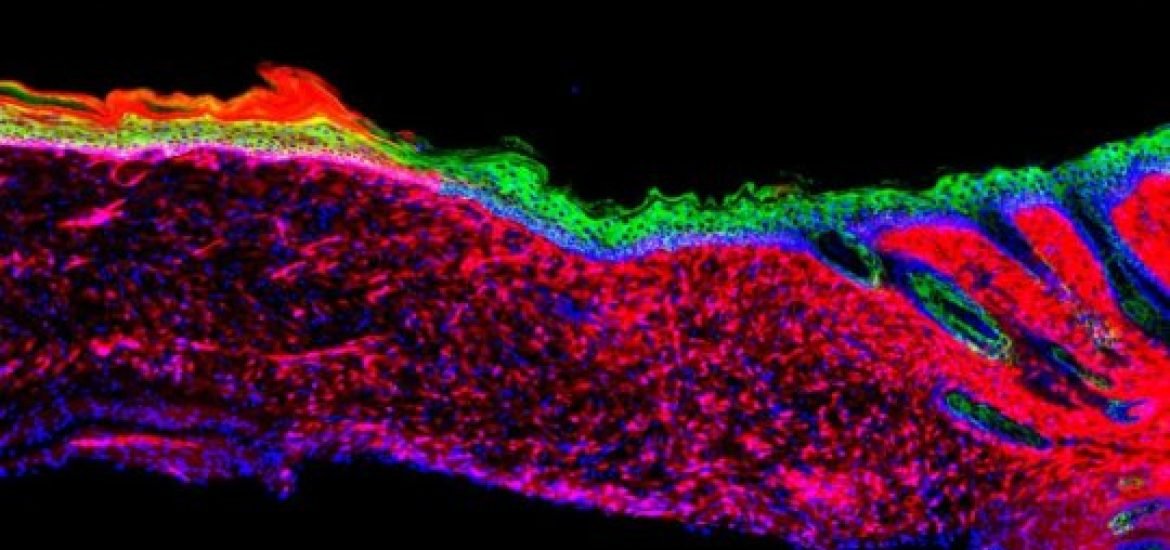 Coaxing scar-forming cells into stem-like cells in vivo as a potential approach to wound healing