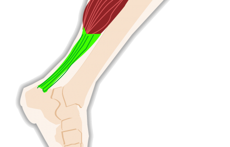 En Irlande, des chercheurs découvrent un moyen d’accélérer la guérison des tendons