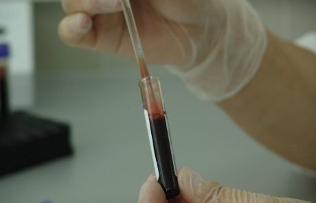 La mutation génétique qui protège contre le VIH existe depuis -7000 ans av J-C