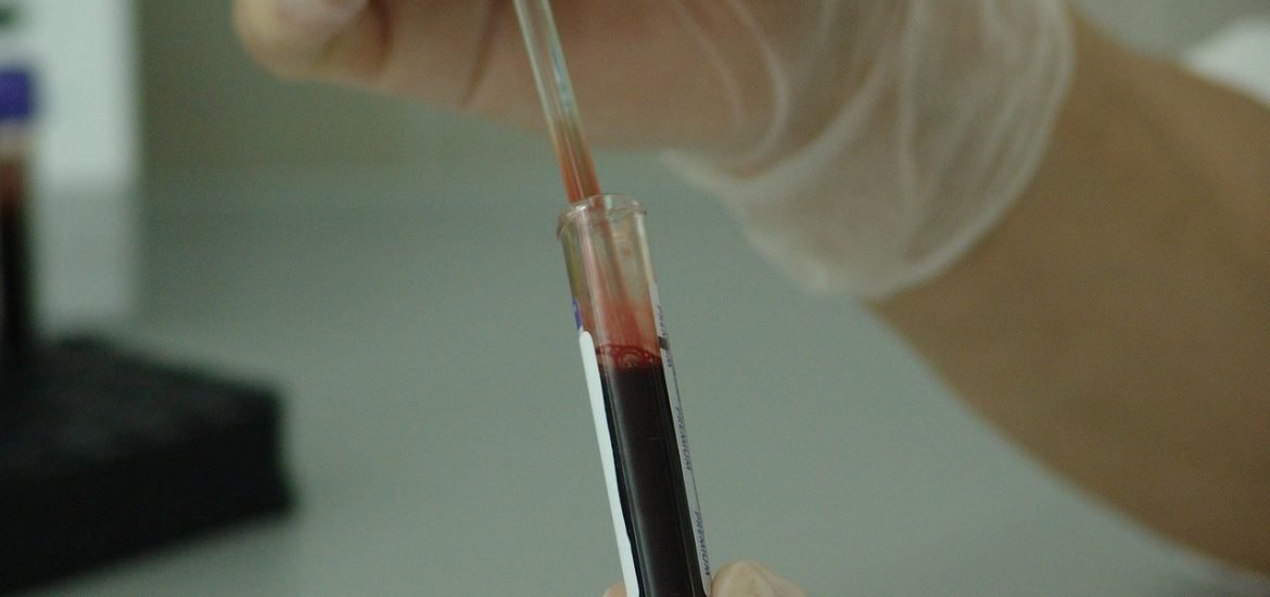 La mutation génétique qui protège contre le VIH existe depuis -7000 ans av J-C